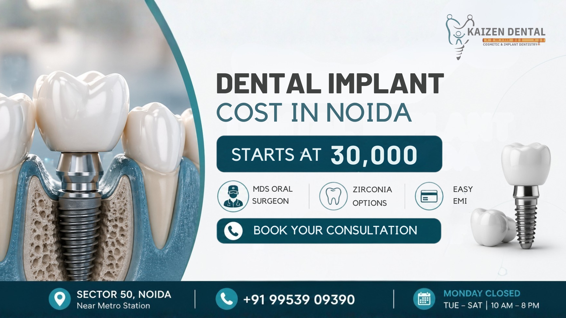 titanium-dental-implant-placement-specialist-Kaizen-Dental-Sector-50-Noida