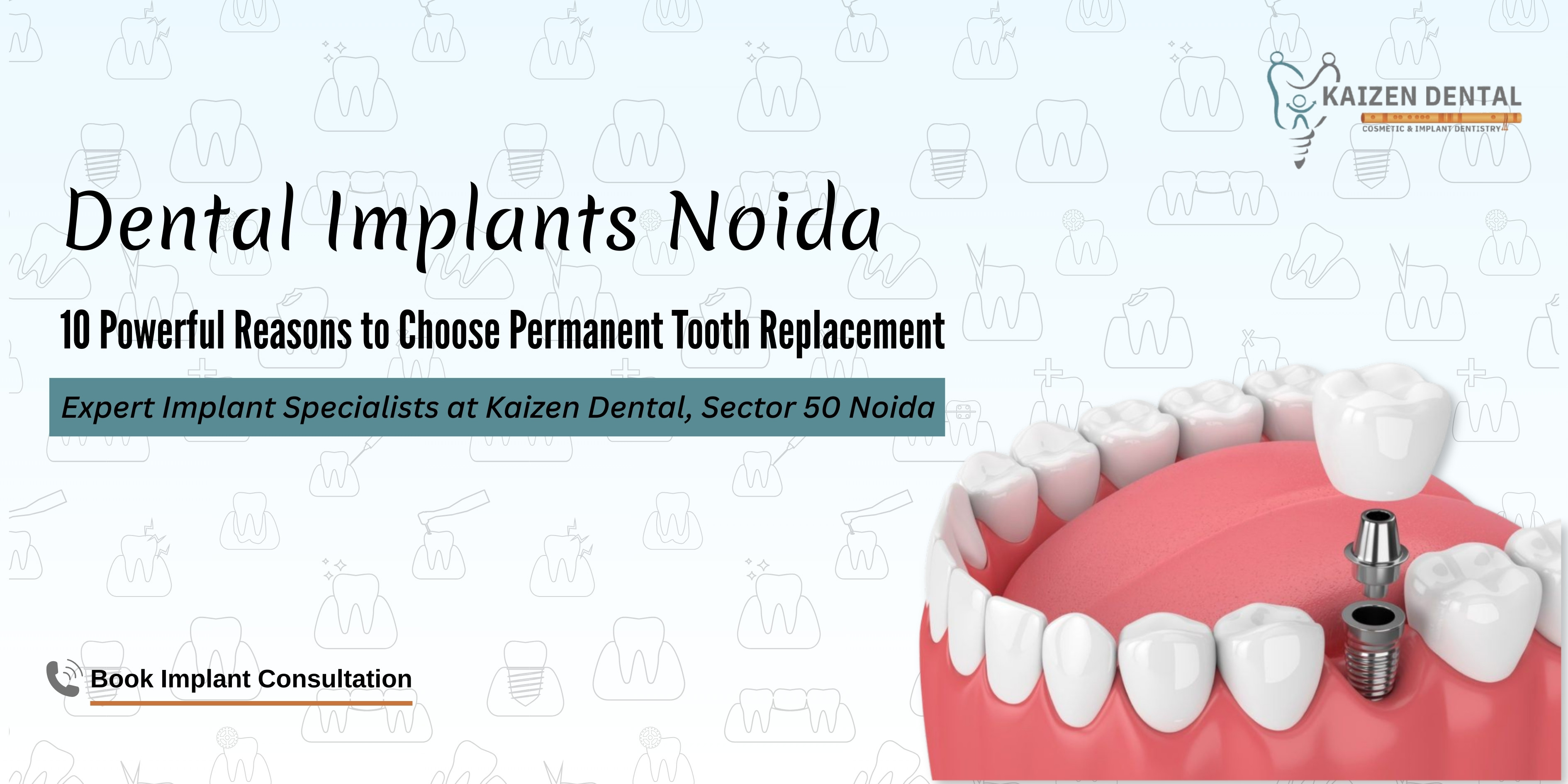 dental-implants-Noida-Kaizen-Dental-Sec-50-missing-teeth-replacement-titanium-implant-crown-natural-smile
