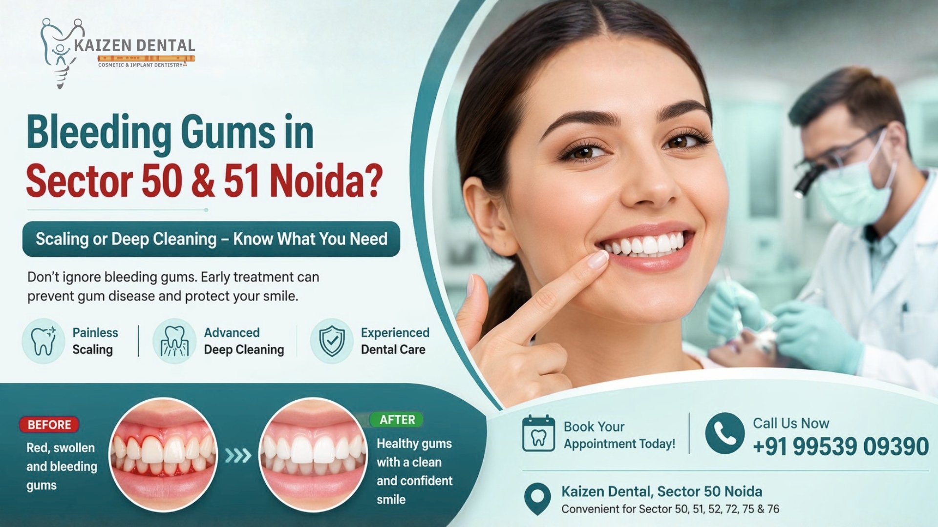 bleeding-gums-in-noida-sector-50-51-scaling-or-deep-cleaning-kaizen-dental