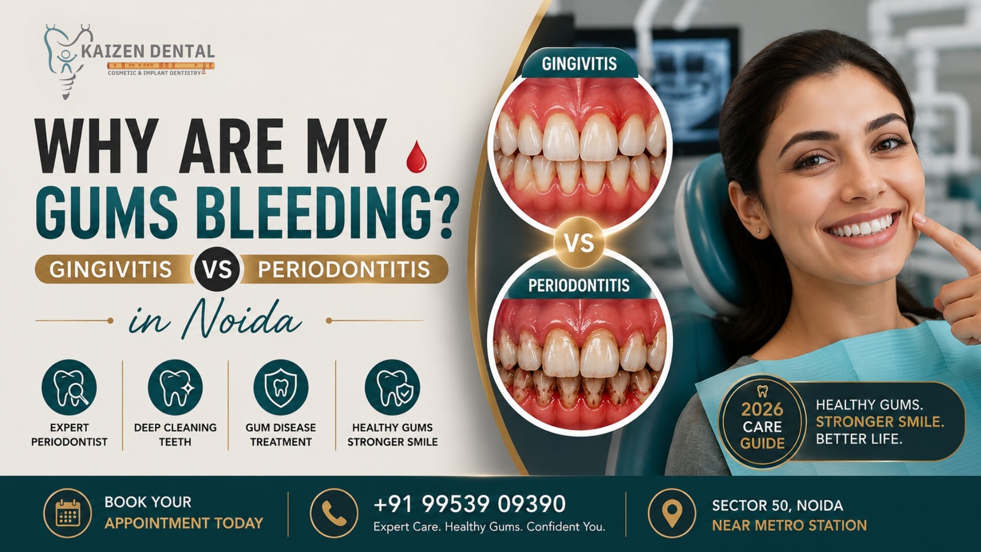 bleeding-gums-treatment-Noida-periodontist-Sector-50-scaling-gum-disease-kaizen-dental-near-metro