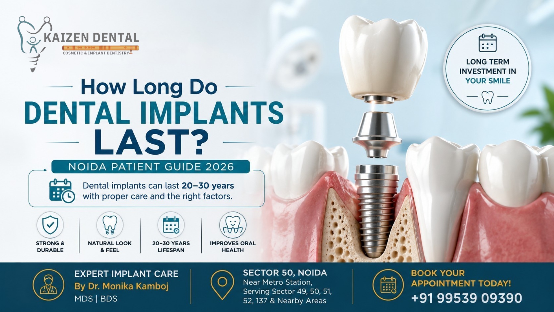 dental-implants-Sector-50-Noida-lifespan-how-long-last-MDS-oral-surgeon-kaizen-dental-near-metro