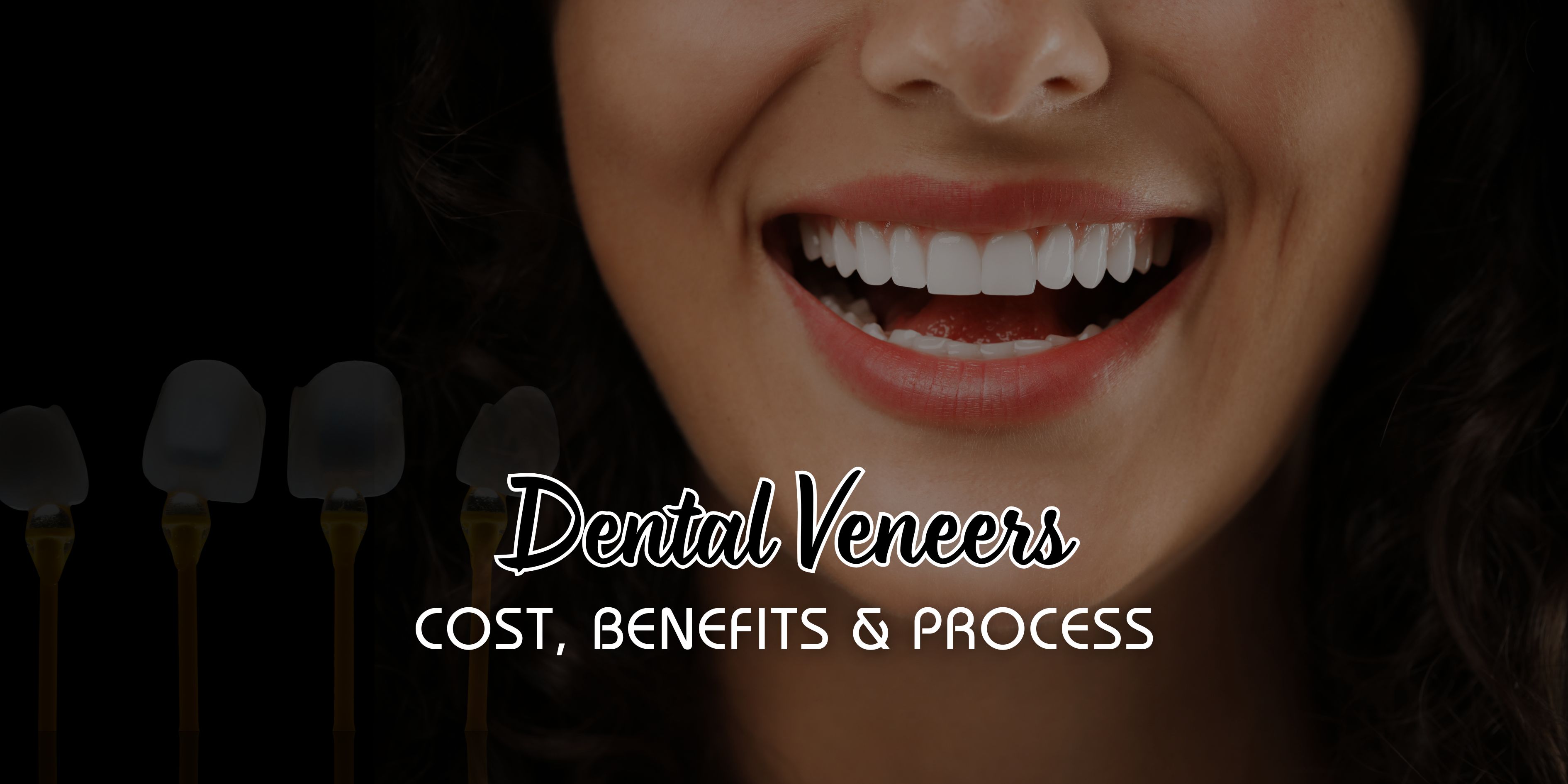 Patient-smiling-after-dental-veneers-treatment-showing-natural-white-teeth-at-Kaizen-Dental-Noida