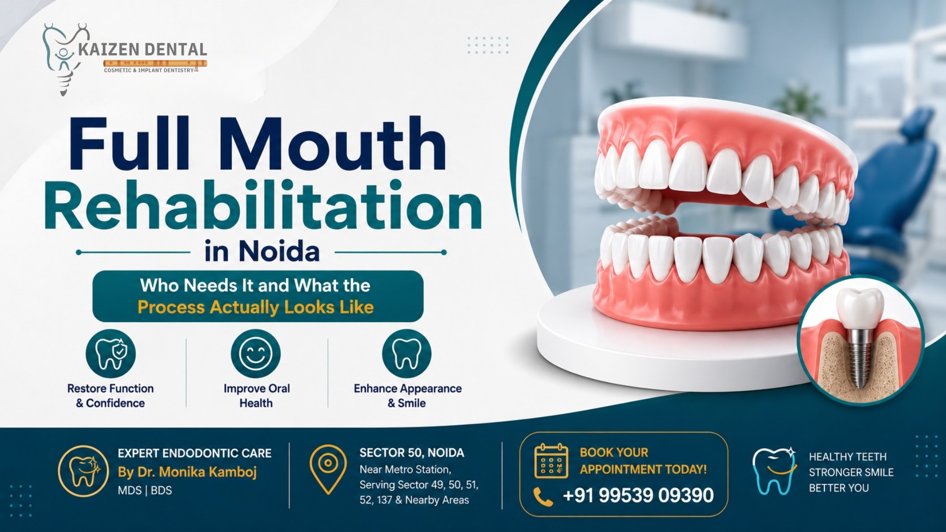 full-mouth-rehabilitation-Noida-Sector-50-MDS-specialist-kaizen-dental-central-50-market-near-metro-station