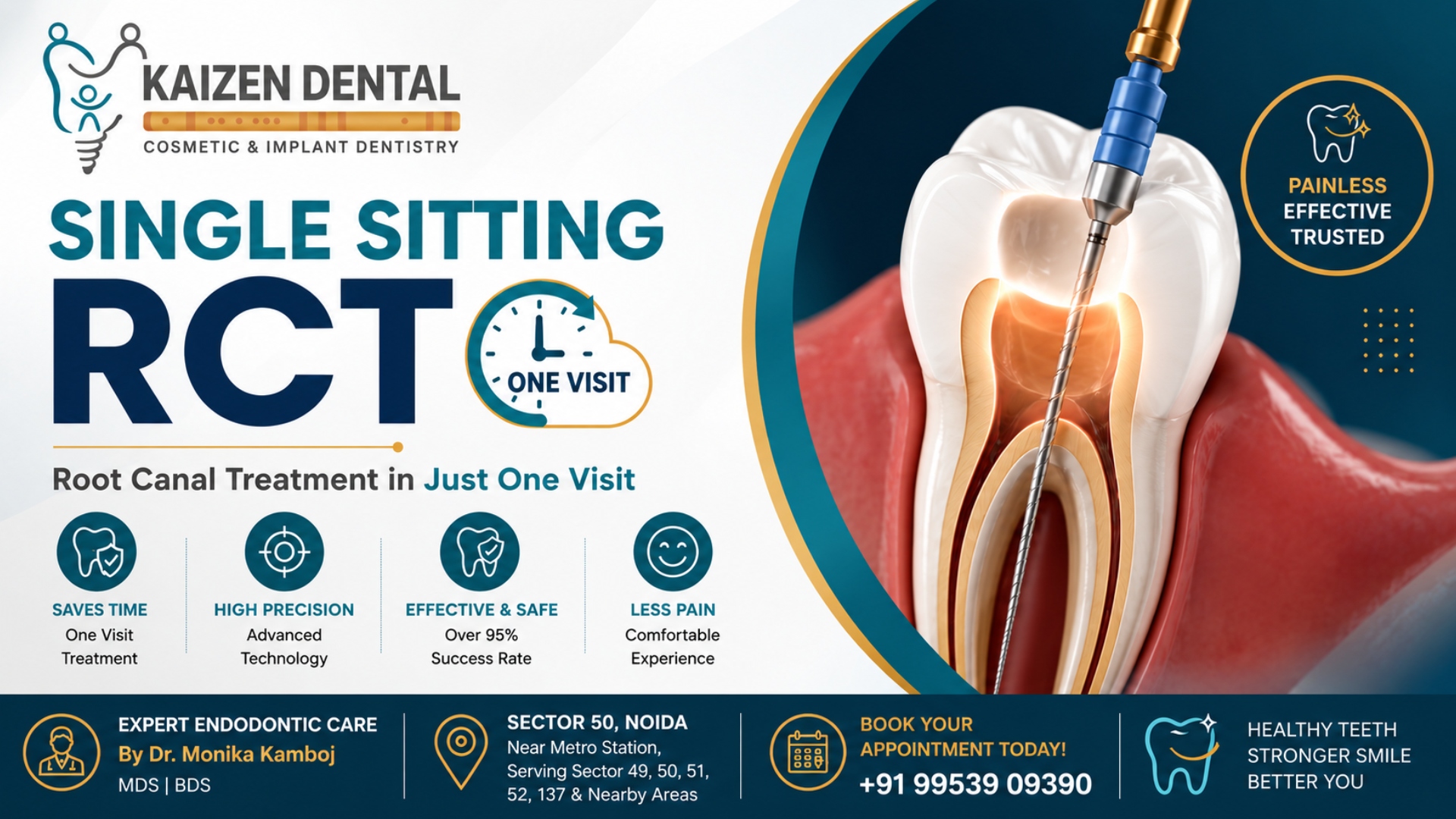 single-sitting-rct-noida-kaizen-dental-sector-50-root-canal-one-visit