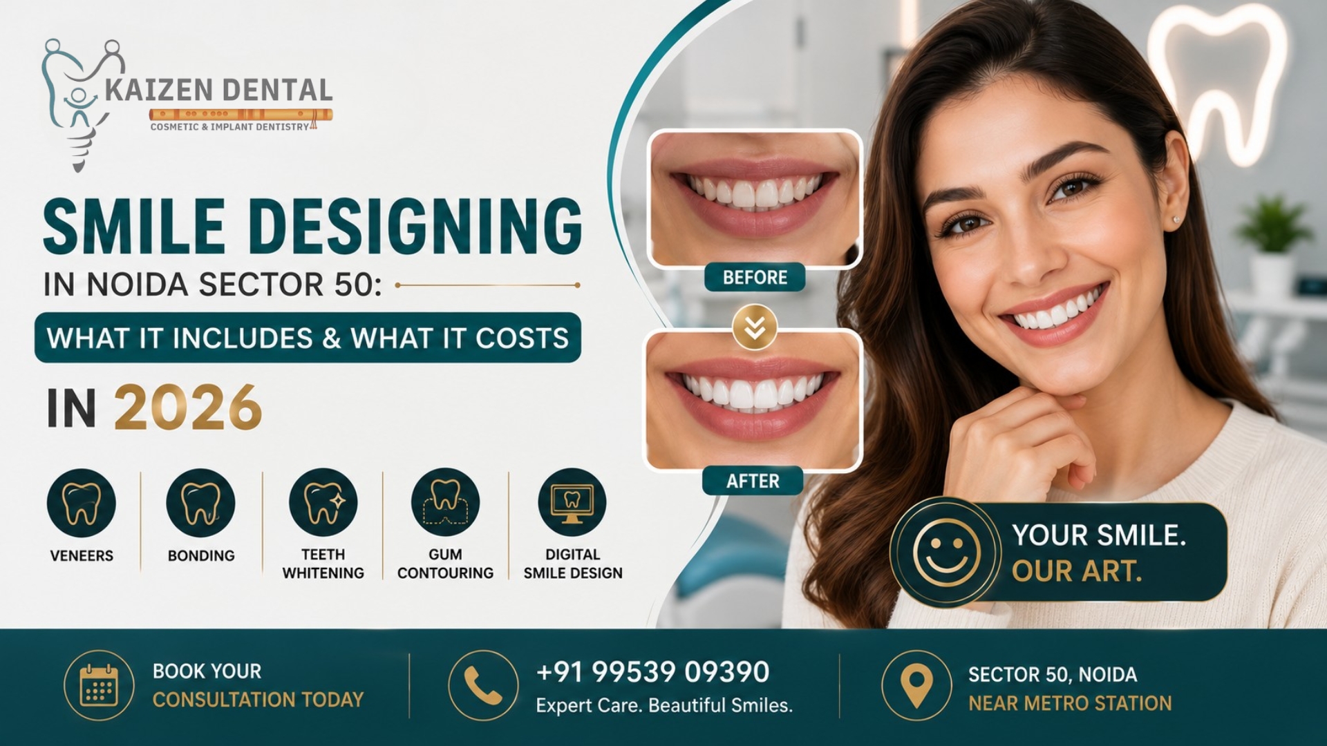 smile-designing-Noida-Sector-50-veneers-bonding-whitening-gum-contouring-kaizen-dental-near-metro-station
