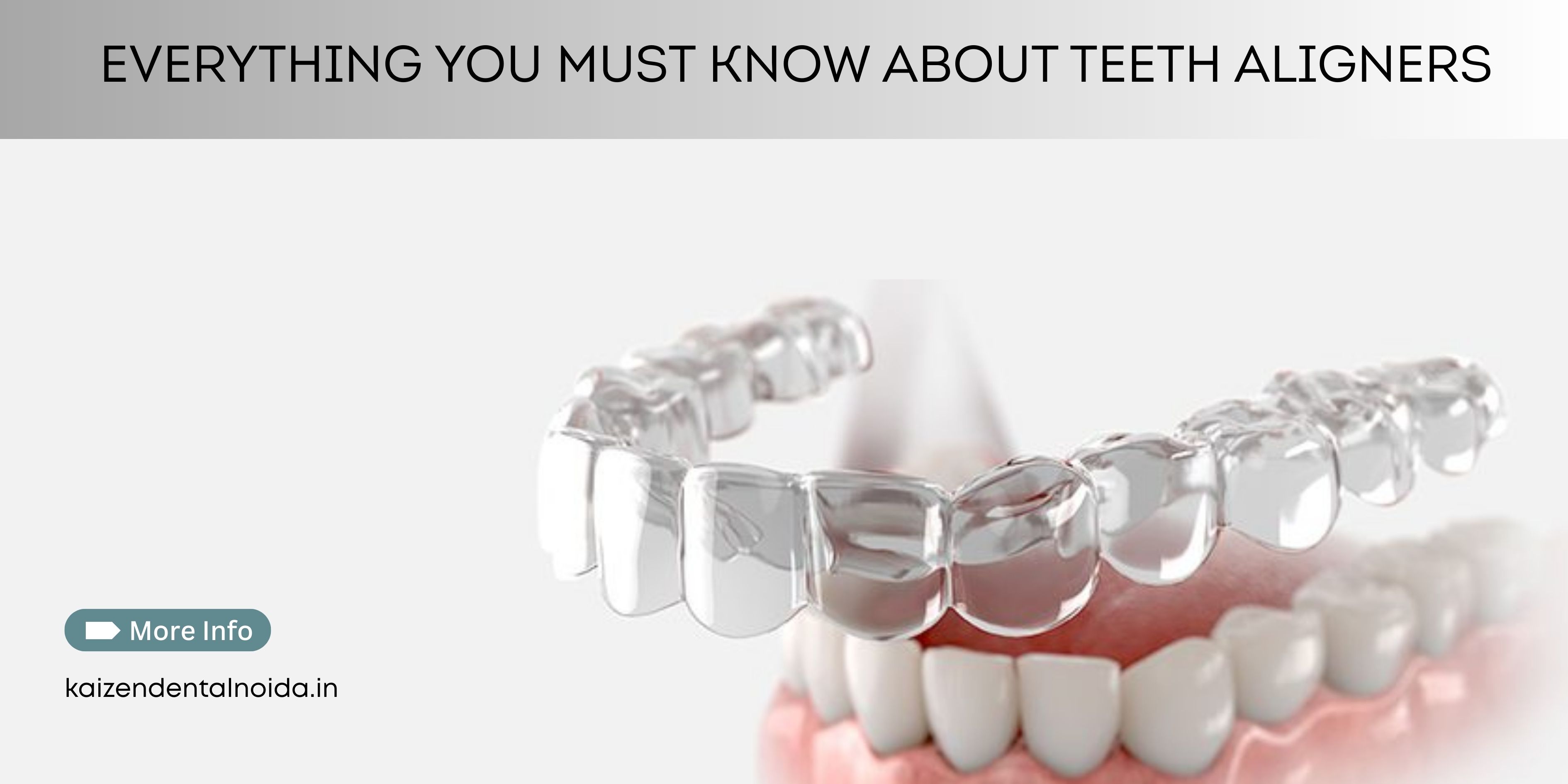 teeth-aligners-treatment-in-sec-50-noida-at-kaizen-dental-clear-aligners-for-any-age-smile-correction