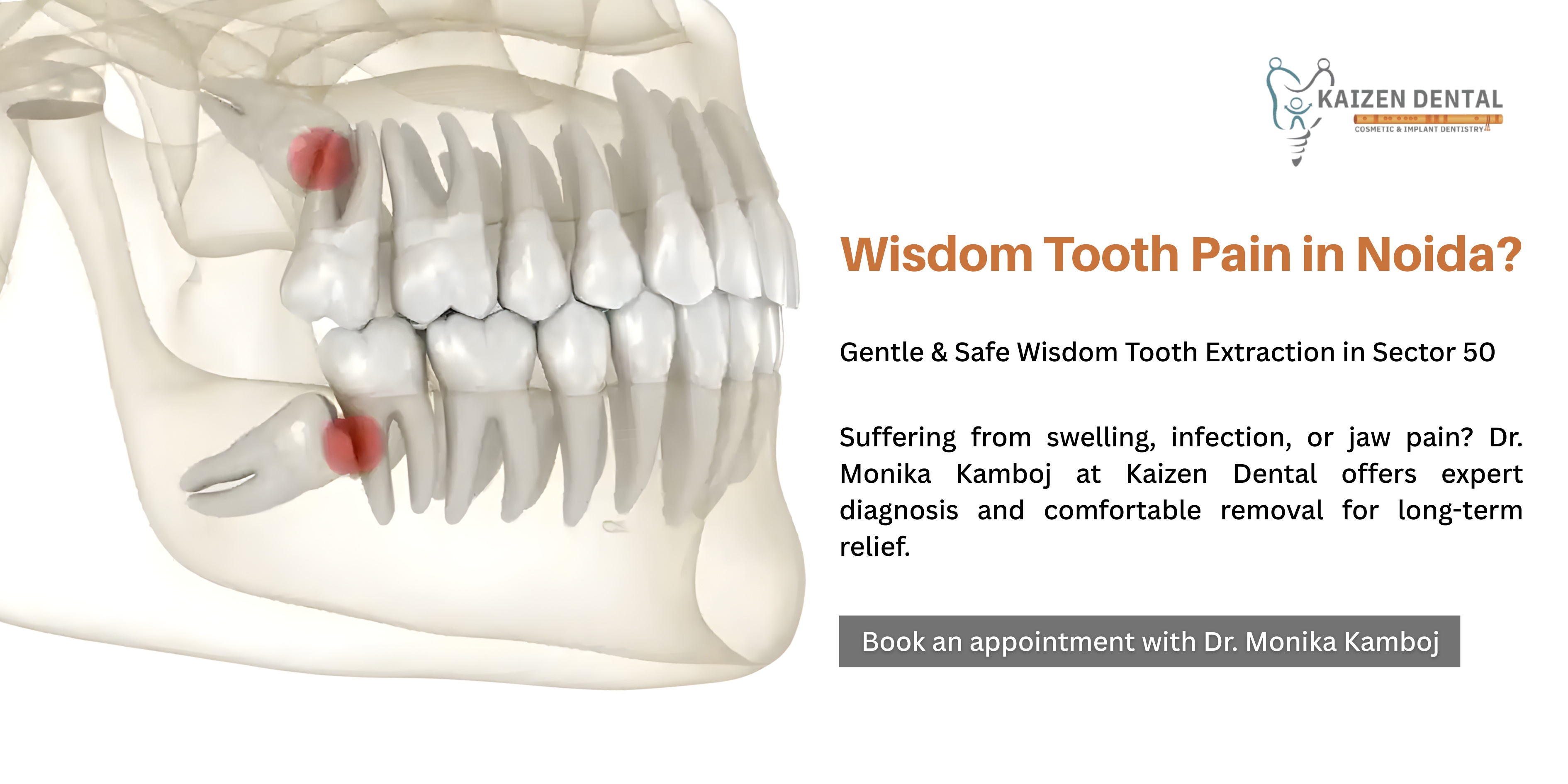 wisdom-tooth-pain-in-noida-sector-50-when-you-really-need-extraction-dentist-examining-impacted-wisdom-tooth-at-kaizen-dental